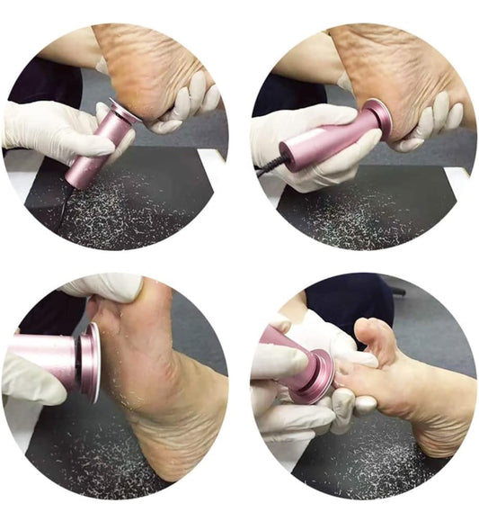 Electric Foot File – 1200 RPM Callus Remover for Smooth Feet